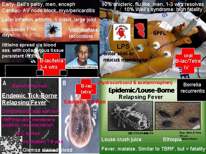 Early- Bell’s palsy, men, enceph Cardiac- AV node block, myo/pericarditis 90% anicteric, flu like,