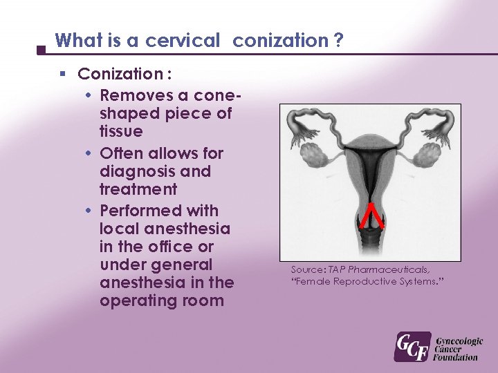 What is a cervical conization ? § Conization : • Removes a coneshaped piece