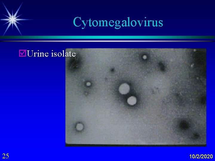 Cytomegalovirus þUrine isolate 25 10/2/2020 