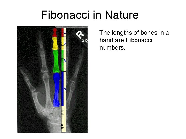 Fibonacci in Nature The lengths of bones in a hand are Fibonacci numbers. 