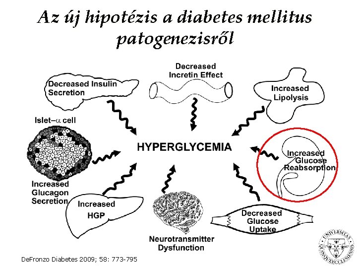 Az új hipotézis a diabetes mellitus patogenezisről De. Fronzo Diabetes 2009; 58: 773 -795