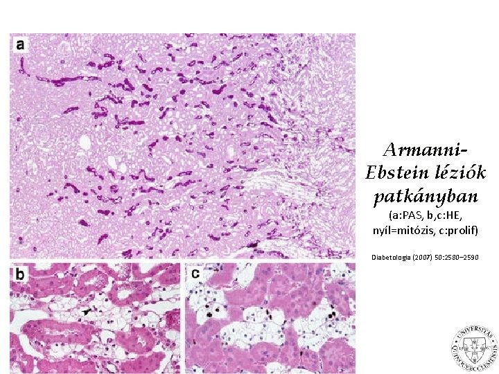 Armanni. Ebstein léziók patkányban (a: PAS, b, c: HE, nyíl=mitózis, c: prolif) Diabetologia (2007)