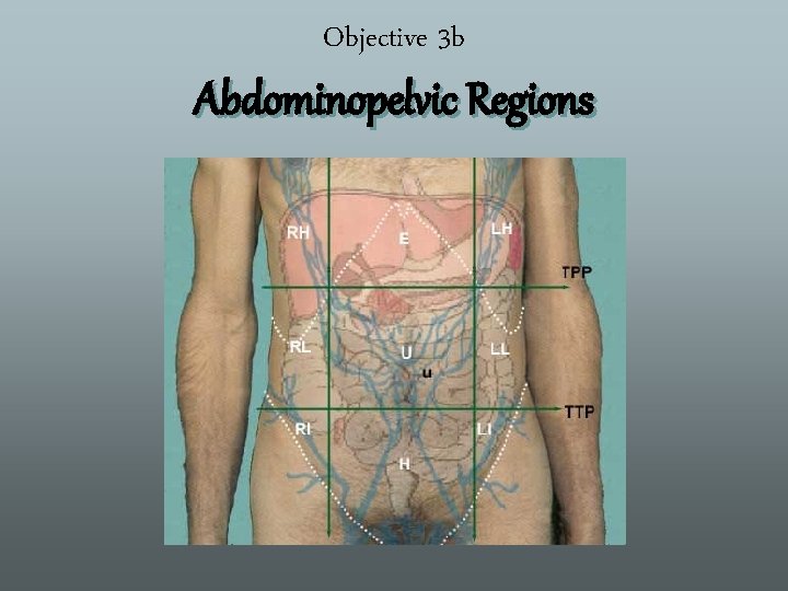 Objective 3 b Abdominopelvic Regions 