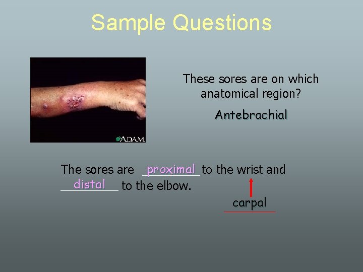 Sample Questions These sores are on which anatomical region? Antebrachial The sores are proximal