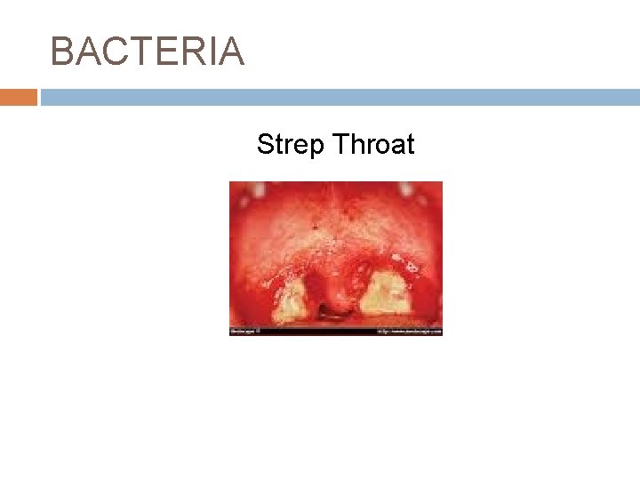 BACTERIA Strep Throat 