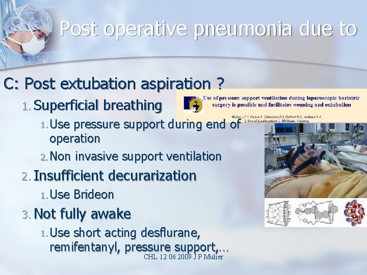 Post operative pneumonia due to C: Post extubation aspiration ? 1. Superficial breathing 1.