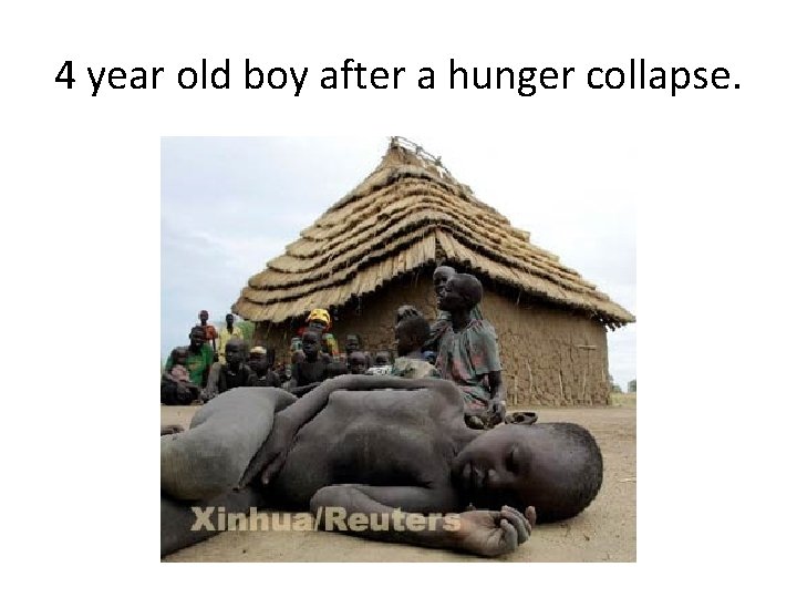 4 year old boy after a hunger collapse. 