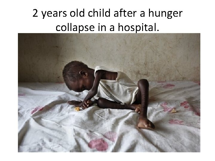 2 years old child after a hunger collapse in a hospital. 