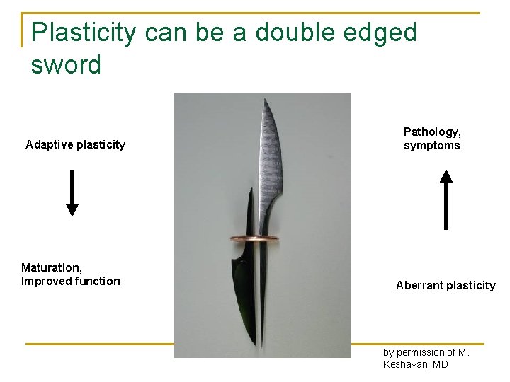Plasticity can be a double edged sword Adaptive plasticity Maturation, Improved function Pathology, symptoms
