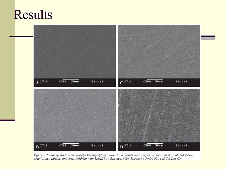 Surface Roughness and Staining Susceptibility of Composite Resins