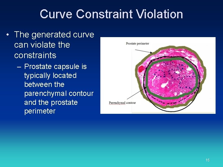 Curve Constraint Violation • The generated curve can violate the constraints – Prostate capsule