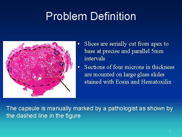 Problem Definition • Slices are serially cut from apex to base at precise and