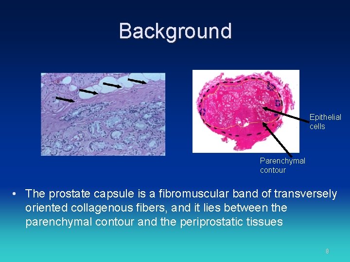 Background Epithelial cells Parenchymal contour • The prostate capsule is a fibromuscular band of