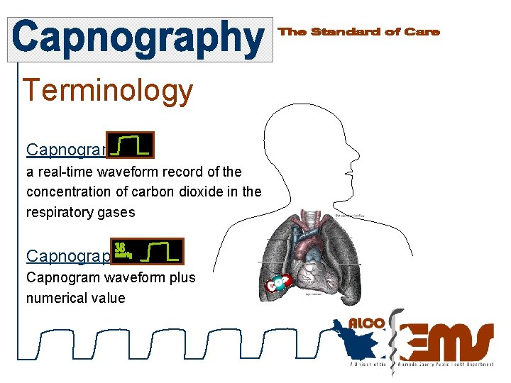 Terminology Capnogram a real-time waveform record of the concentration of carbon dioxide in the