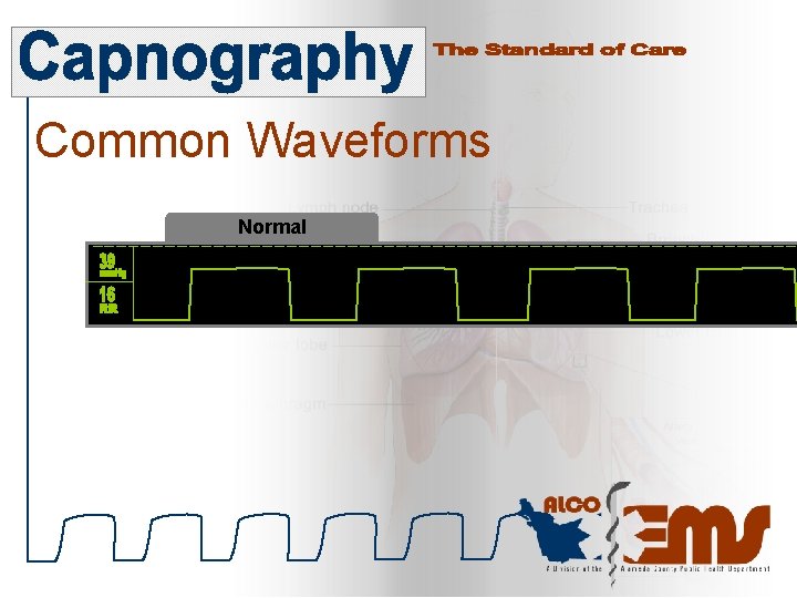 Common Waveforms Normal 