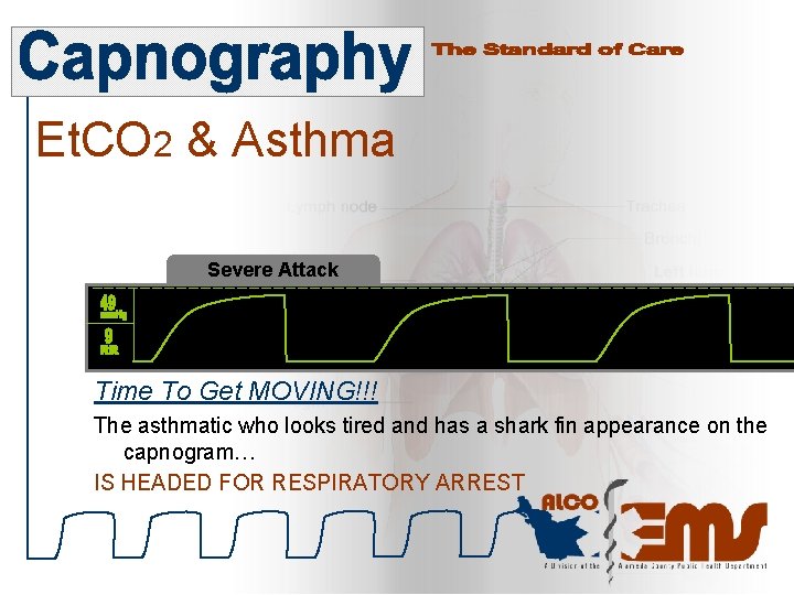 Et. CO 2 & Asthma Severe Attack Time To Get MOVING!!! The asthmatic who