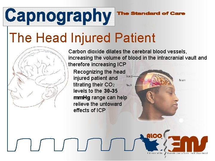 The Head Injured Patient Carbon dioxide dilates the cerebral blood vessels, increasing the volume