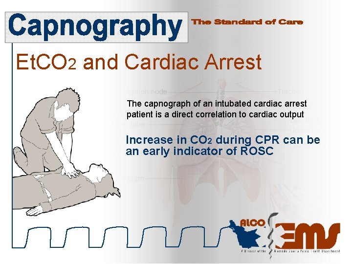 Et. CO 2 and Cardiac Arrest The capnograph of an intubated cardiac arrest patient