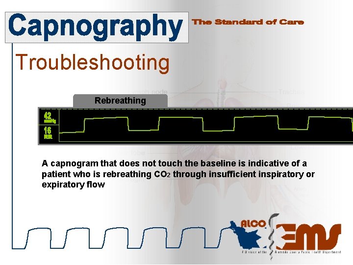 Troubleshooting Rebreathing A capnogram that does not touch the baseline is indicative of a