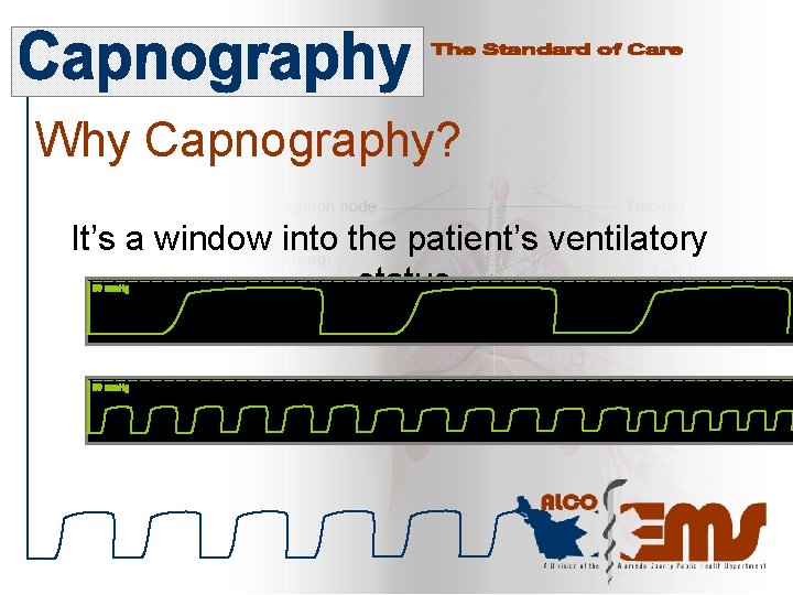 Why Capnography? It’s a window into the patient’s ventilatory status 