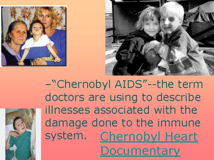 –“Chernobyl AIDS”--the term doctors are using to describe illnesses associated with the damage done