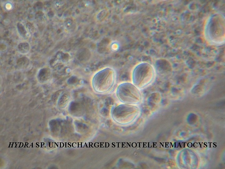 HYDRA SP. UNDISCHARGED STENOTELE NEMATOCYSTS 