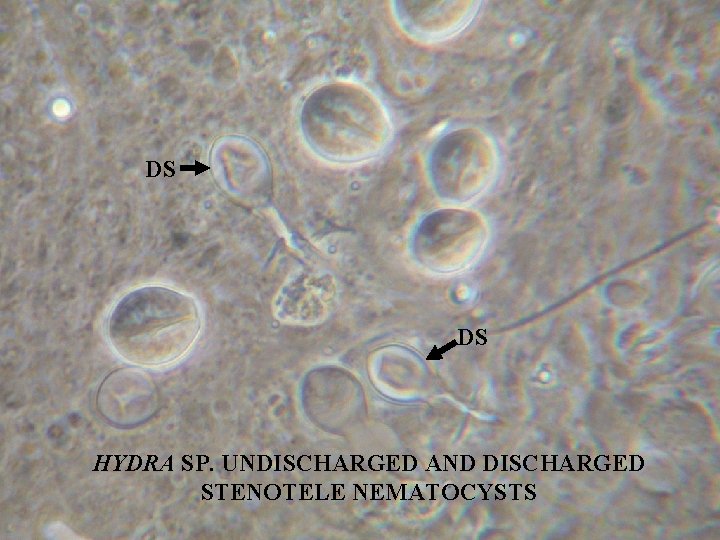 DS DS HYDRA SP. UNDISCHARGED AND DISCHARGED STENOTELE NEMATOCYSTS 