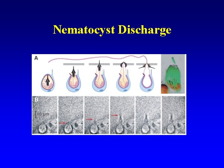 Nematocyst Discharge 