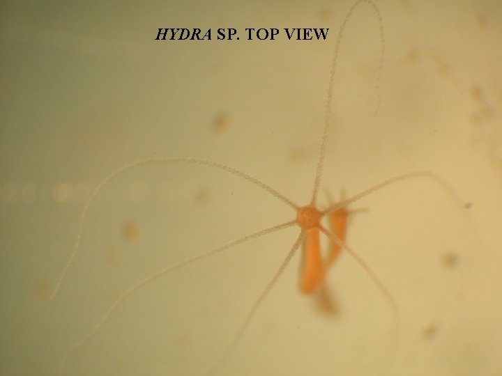 HYDRA SP. TOP VIEW 