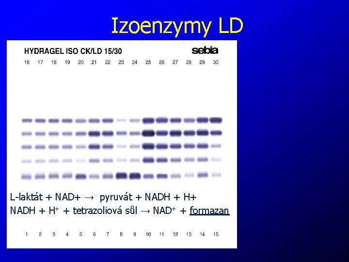 Izoenzymy LD L-laktát + NAD+ → pyruvát + NADH + H+ + tetrazoliová sůl