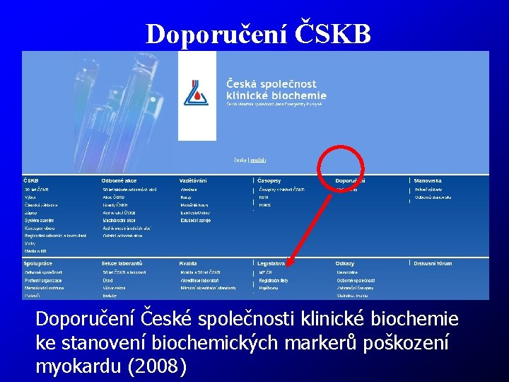 Doporučení ČSKB Doporučení České společnosti klinické biochemie ke stanovení biochemických markerů poškození myokardu (2008)