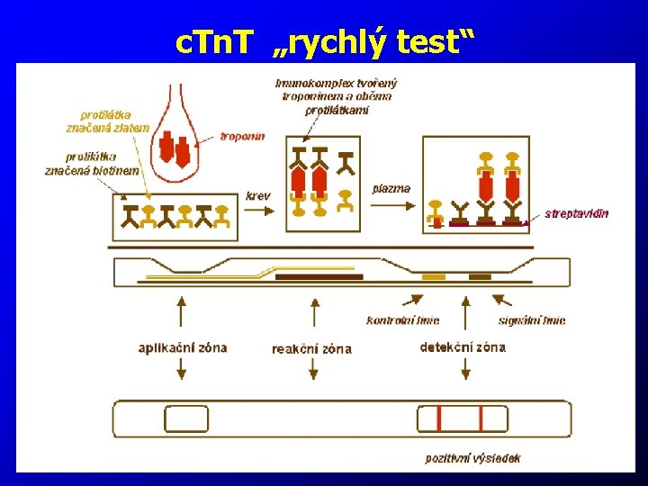 c. Tn. T „rychlý test“ 30 