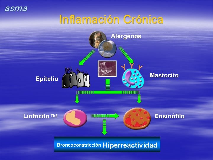 asma Inflamación Crónica Alergenos Epitelio Linfocito Th 2 Mastocito Eosinófilo Broncoconstricción Hiperreactividad 