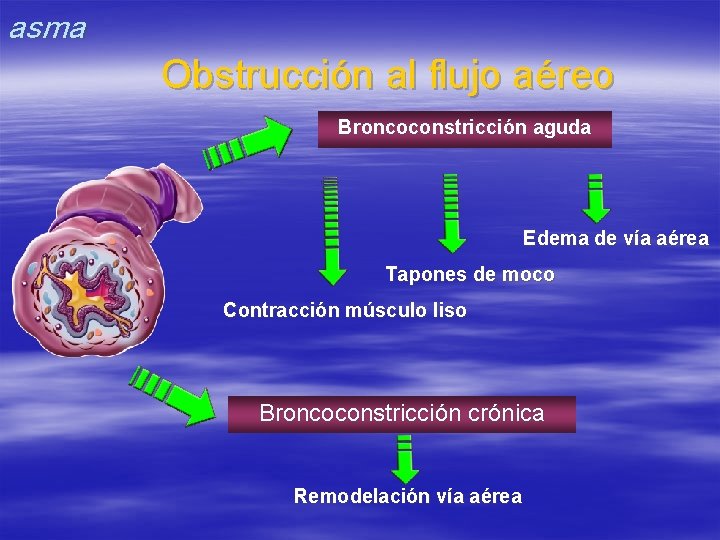 asma Obstrucción al flujo aéreo Broncoconstricción aguda Edema de vía aérea Tapones de moco