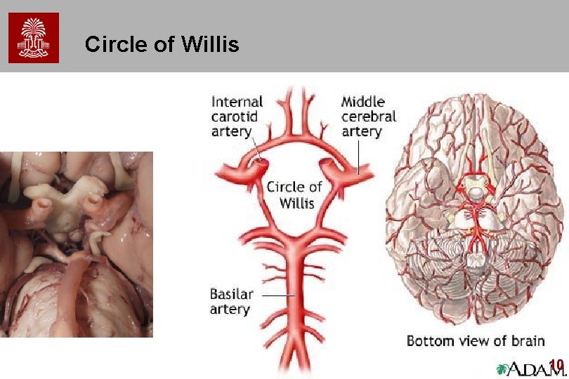 Circle of Willis 10 