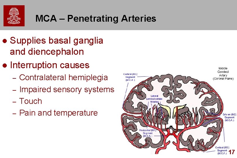 MCA – Penetrating Arteries Supplies basal ganglia and diencephalon l Interruption causes l –