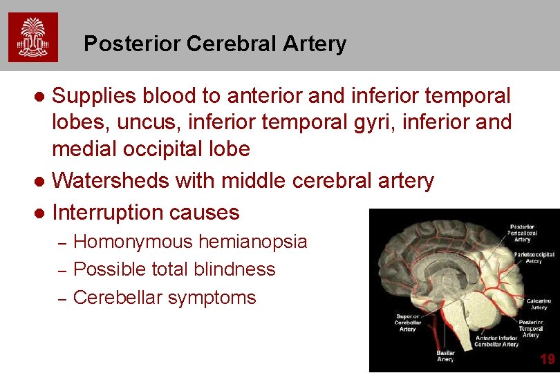 Posterior Cerebral Artery Supplies blood to anterior and inferior temporal lobes, uncus, inferior temporal