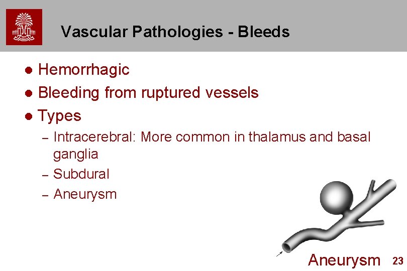 Vascular Pathologies - Bleeds Hemorrhagic l Bleeding from ruptured vessels l Types l –