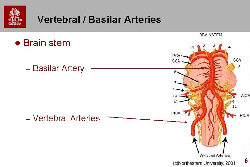 Vertebral / Basilar Arteries l Brain stem – Basilar Artery – Vertebral Arteries 6