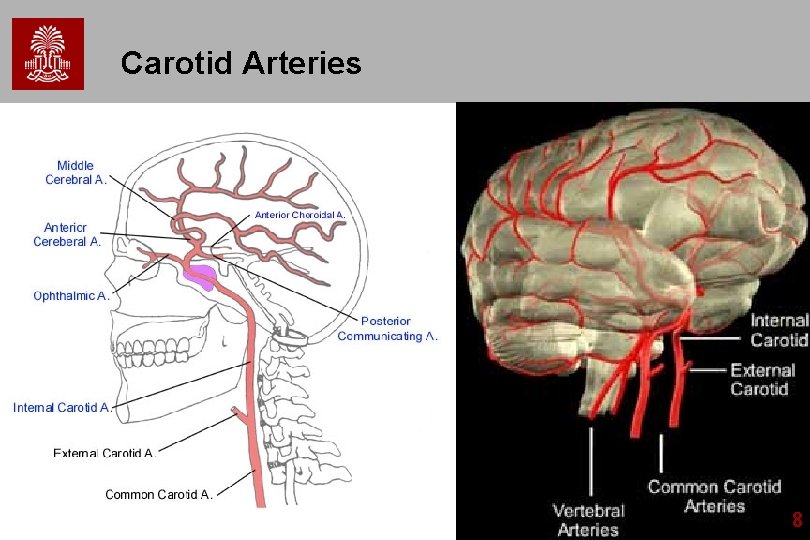 Carotid Arteries 8 