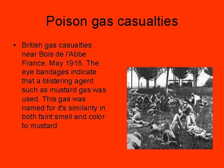 Poison gas casualties • British gas casualties near Bois de l'Abbe France, May 1918.