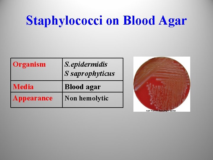 Staphylococci on Blood Agar Organism S. epidermidis S saprophyticus Media Appearance Blood agar Non