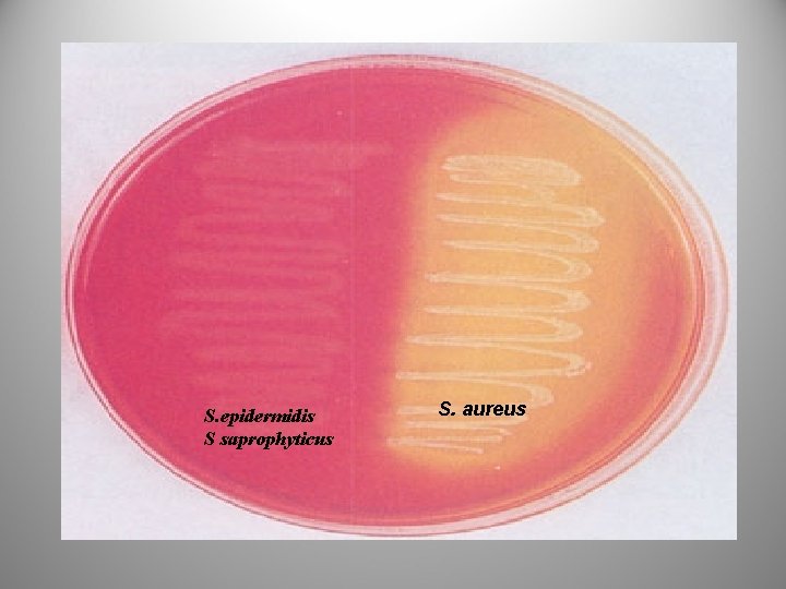 S. epidermidis S saprophyticus S. aureus 