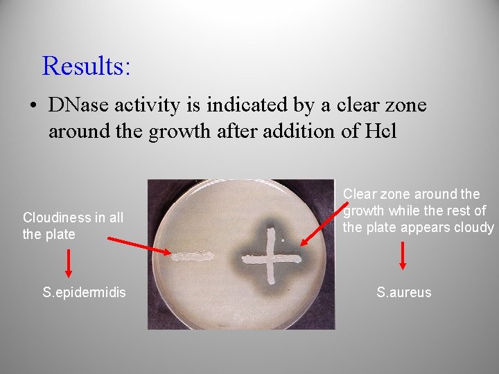 Results: • DNase activity is indicated by a clear zone around the growth after