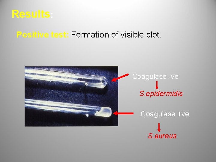 Results: Positive test: Formation of visible clot. Coagulase -ve S. epidermidis Coagulase +ve S.