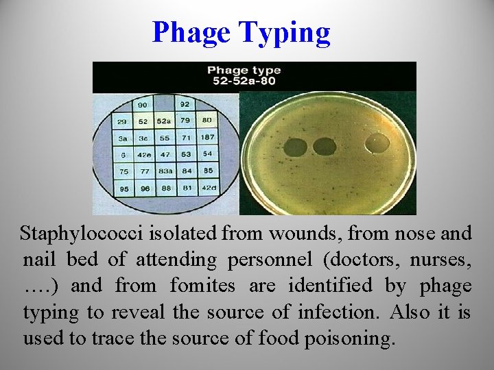 Phage Typing Staphylococci isolated from wounds, from nose and nail bed of attending personnel