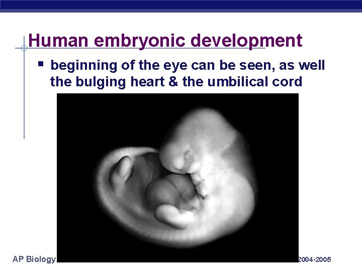 Human embryonic development § beginning of the eye can be seen, as well the
