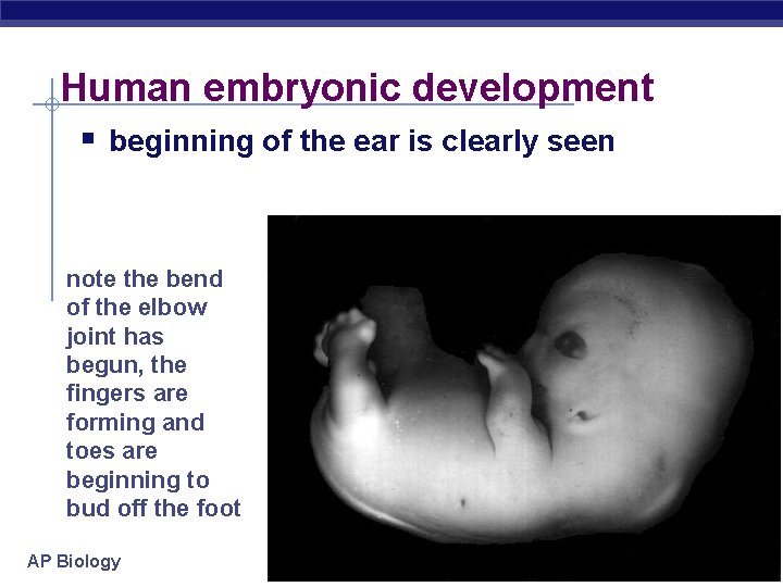 Human embryonic development § beginning of the ear is clearly seen note the bend