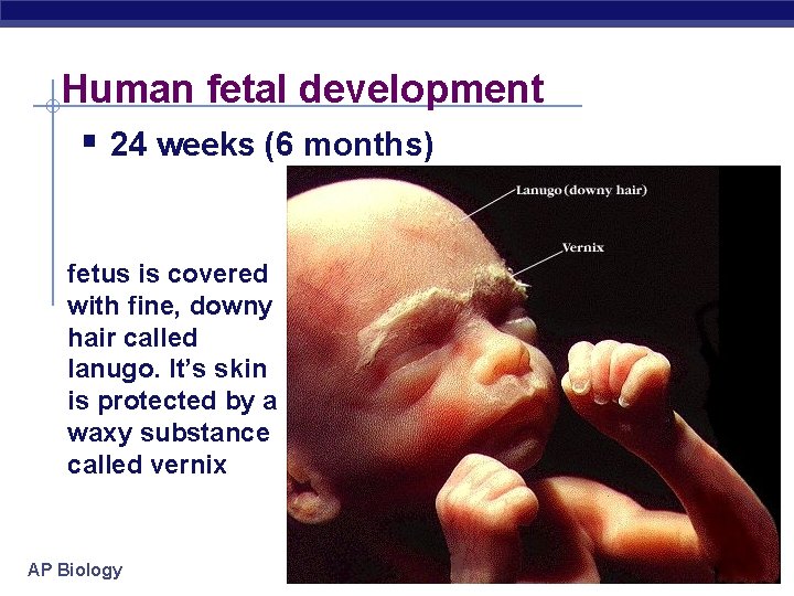 Human fetal development § 24 weeks (6 months) fetus is covered with fine, downy