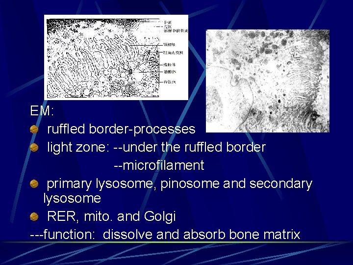 EM: ruffled border-processes light zone: --under the ruffled border --microfilament primary lysosome, pinosome and